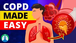 COPD Made Easy  Types Causes Symptoms and Treatment [upl. by Elleimac]