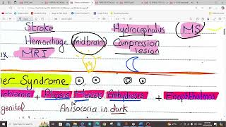 NEUROOPTHALMOLOGY PART I  OPTHALMOLOGY  5TH YEAR [upl. by Naarah]