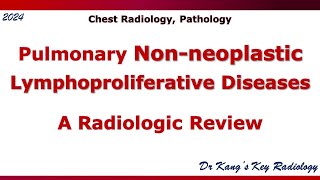 Pulmonary Nonneoplastic lymphoproliferative disease LPD [upl. by Quintessa]