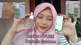 REVIEW NPURE CENTELLA ESSENCE [upl. by Ayalahs]