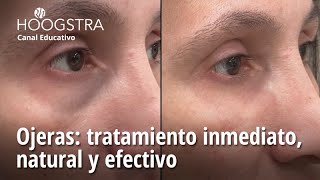 Ojeras tratamiento inmediato natural y efectivo  24130 [upl. by Chalmers]