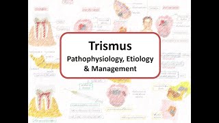 Trismus or Lockjaw Pathophysiology Etiology amp Management [upl. by Betta]