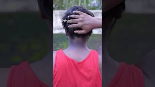 Neck Cleaning Tips  Dark Neck Remove Home RemediesGet Rid Of Dark Neck dark shorts viralvideo [upl. by Airol145]