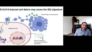 “Systemic inflammation and other unexpected surprises in the host response to SARSCoV2” [upl. by Thetos]