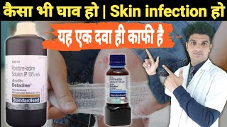 Betadine solution uses in hindi  Povidon iodine solution [upl. by Jurdi]