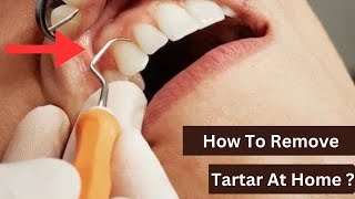 Is it Possible To Remove Tartar At Home [upl. by Duleba568]