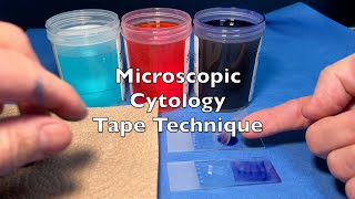 Microscopic Cytology Tape Technique [upl. by Inimod]