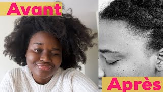 Solution pour la perte des cheveux devant du crâne tempe  DIY  Bantu Fro [upl. by Eenafit75]