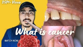 What Is Cancer What Causes Cancer amp How Is It Treated Episode 1 [upl. by Aneris]