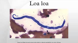 Loa loa [upl. by Ten]