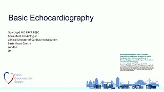 Basic Echocardiography Review echocardiogram [upl. by Tingley]