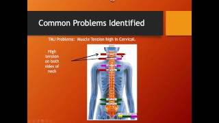 EP Stress Score Simplifying Interpretation of Static sEMG [upl. by Sidonnie]