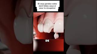 Processus de réparation dune dent shortvideo sciencepopulaire shorts dentist shortviral [upl. by Ratha]