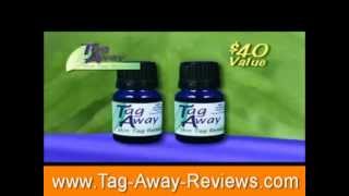 Tag Away Reviews  wwwTagAwayReviewscom  Skin Tag Removal Remedy [upl. by Sitto]