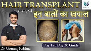 हेयर ट्रांसप्लांट के बाद क्या करे After Hair Transplant Care in 2024  Medlinks Hair Transplant [upl. by Ashman]