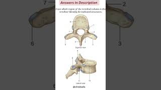 identify the parts of vertebrae humananatomy [upl. by Rosa896]