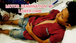 motor examination of lower limb paediatrics neurological examination lMN examinationpaediatrics [upl. by Kenzie341]