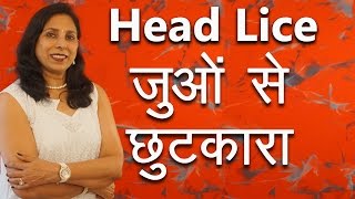 जुओं से छुटकारा कैसे पाएं  How to remove Head Lice with Home Remedies  Ms Pinky Madaan [upl. by Dlared]