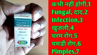 Tocin 80 injectiontobramycin injection uses in hindi [upl. by Navar861]