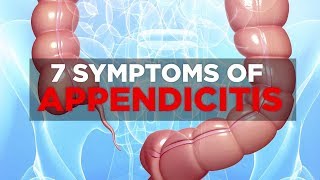 7 Symptoms of Appendicitis  Health [upl. by Kral381]