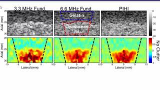 Improved Estimation Of Ultrasound Thermal Strain Using Pulse Inversion Harmonic Imaging PIHI [upl. by Ganiats]