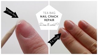 Natural Nails  Repair Cracked Nails Using Tea Bags [upl. by Ainek]