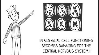 ALS and glial cells [upl. by Ariel]