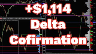 1114 Day Trading Emini SP 500 Futures  Cumulative Delta Recorded Live March 8th  930 EST NYSE [upl. by Schroder]