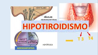 HIPOTIROIDISMO eje hipotálamohipófisis [upl. by Robina]