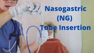 Nasogastric NG Tube Insertion [upl. by Sneve]