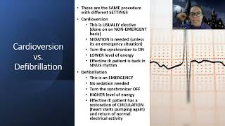 Adult MedSurg Dysrhythmia NEW Lecture Defibrillation vs Cardioversion [upl. by Jillie409]