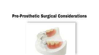 PreProsthetic Surgical Considerations طب الاسنان مرحلة رابعة prosthodontic [upl. by Ryan]