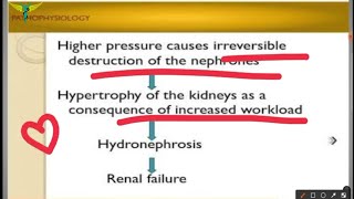 Hydronephrosis [upl. by Mike]