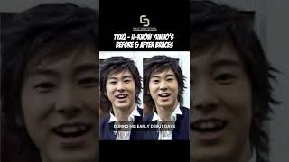 TVXQ  UKnow Yunho’s before amp after braces [upl. by Ragouzis]