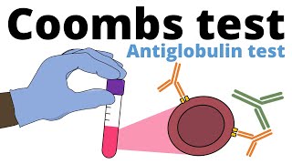 Coombs Test antiglobulin test [upl. by Syman590]