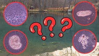 10 Microscopic Organisms I Found in a Drop of Pond Water [upl. by Bitthia]