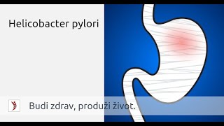 Helicobacter pylori • Heliko bakterija simptomi i lečenje [upl. by Ellednahs]