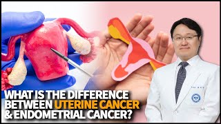 What is the difference between Uterine Cancer and Endometrial Cancer What is its survival rate [upl. by Ramsey]