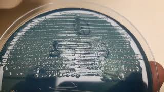 Proteus mirabilis Colony morphology on CLED agar [upl. by Launce232]