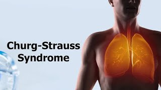 Churg Strauss Syndrome  Eosinophilic Granulomatosis With Polyangiitis Causes and treatment [upl. by Dareg]