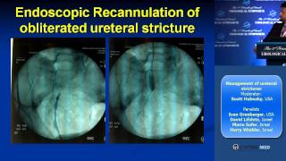 Panel Management of ureteral strictures [upl. by Gnilrad635]