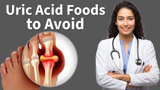 High Uric Acid Foods you should Avoid [upl. by Gen]