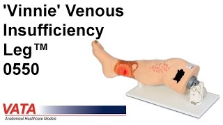 0550  Vinnie Venous Insufficiency Leg™ [upl. by Tini]