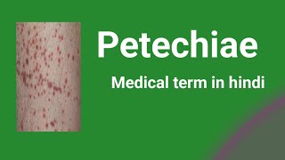 PetechiaeMedical term in hindi [upl. by Ardnat]