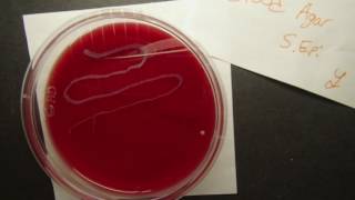 Gamma Hemolysis Staphylococcus epidermidisBlood Agar [upl. by Barden]