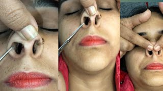 Nose hair cutting and nose massagenosehaircuttingpignosepiggynosemassagepummybeautyworld [upl. by Atinar]