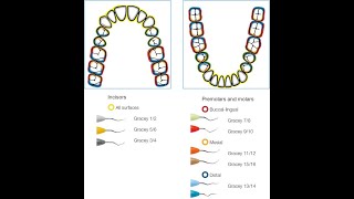 1st demo for how to use scaler and Gracey curette [upl. by Yllas]