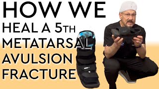 How We Heal a 5th Metatarsal Avulsion Fracture [upl. by Vlad70]