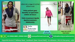 पोलियो पेशेंट को 24 घंटे में ही मिले ऑपरेशन अनेक फायदे Polio treatment polio poliotreatment [upl. by Gnirps]