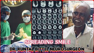 Spreading Smile  Chronic Subdural Hematoma  SDH  Complete Recovery  NEET UG  NEET PG  NEET SS [upl. by Elwood]